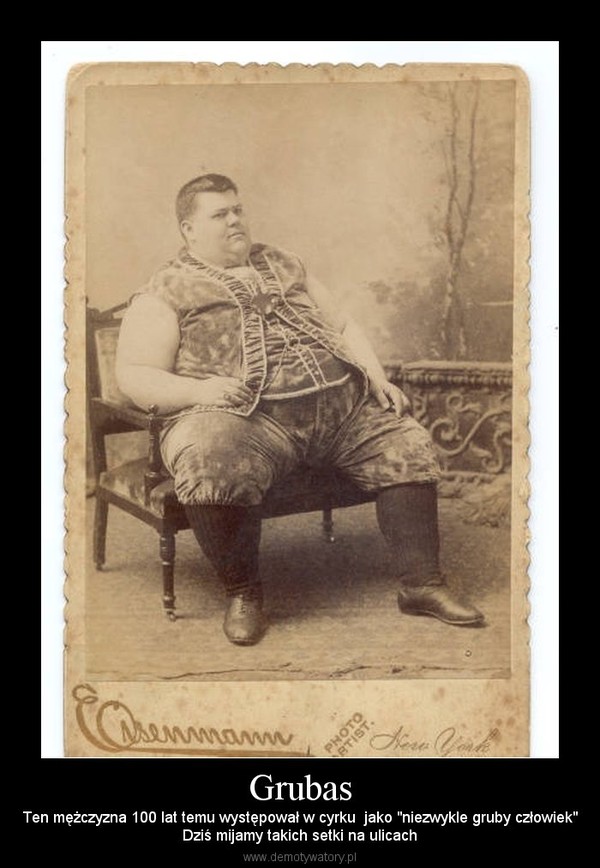 Grubas – Ten mężczyzna 100 lat temu występował w cyrku  jako "niezwykle gruby człowiek"Dziś mijamy takich setki na ulicach 