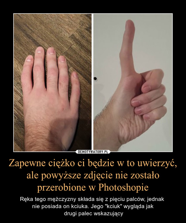 Zapewne ciężko ci będzie w to uwierzyć, ale powyższe zdjęcie nie zostało przerobione w Photoshopie – Ręka tego mężczyzny składa się z pięciu palców, jednak nie posiada on kciuka. Jego "kciuk" wygląda jak drugi palec wskazujący 