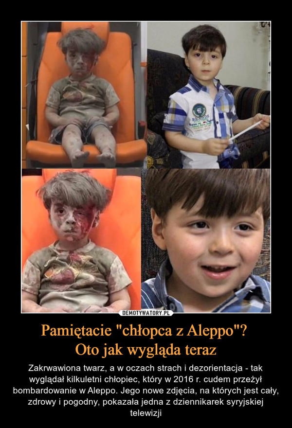 Pamiętacie "chłopca z Aleppo"? 
Oto jak wygląda teraz