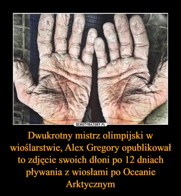 Dwukrotny mistrz olimpijski w wioślarstwie, Alex Gregory opublikował to zdjęcie swoich dłoni po 12 dniach pływania z wiosłami po Oceanie Arktycznym –  
