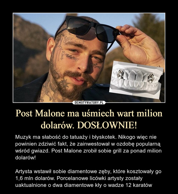 Post Malone ma uśmiech wart milion dolarów. DOSŁOWNIE!