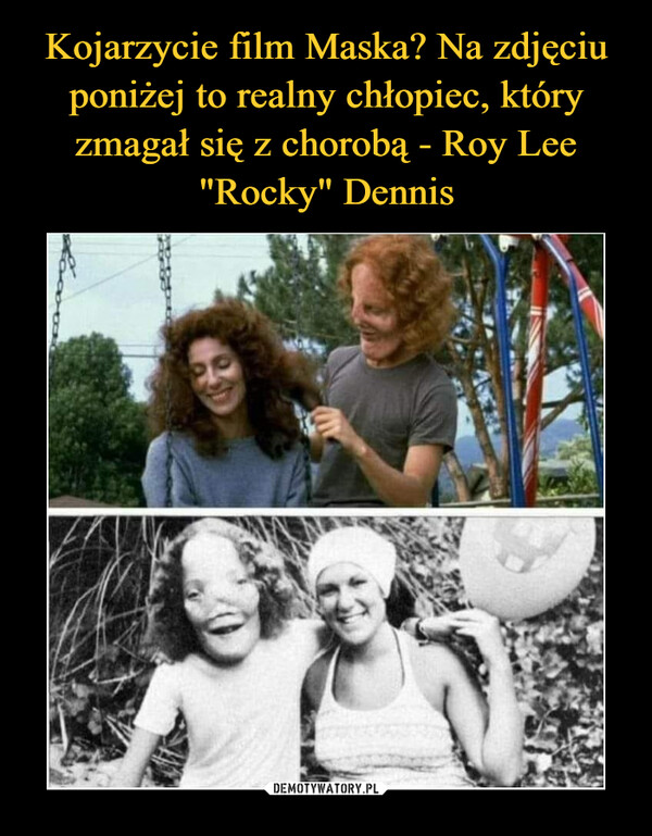 Kojarzycie film Maska? Na zdjęciu poniżej to realny chłopiec, który zmagał się z chorobą - Roy Lee "Rocky" Dennis