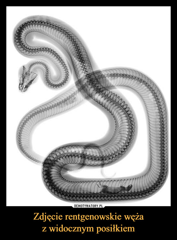 Zdjęcie rentgenowskie wężaz widocznym posiłkiem –  